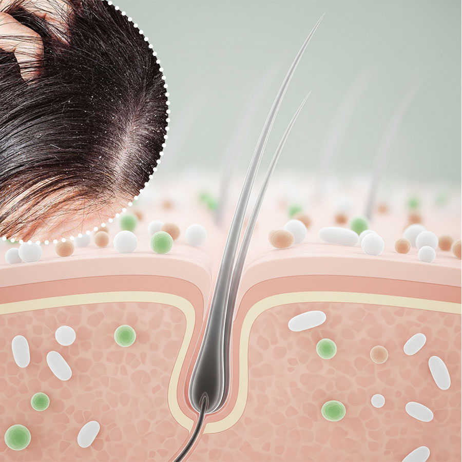 nguyen-nhan-gay-gau-va-ngua-da-dau