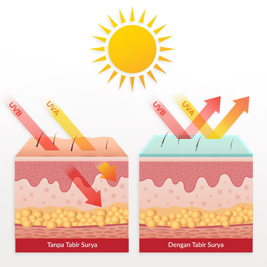 Minh họa tác hại của tia UVA và UVB lên các lớp biểu bì và hạ bì của da