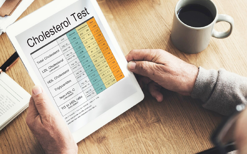 LDL – Cholesterol - Nichiei Asia