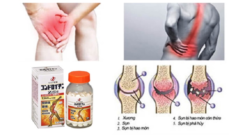 Ai nên uống thuốc bổ sung sụn khớp ZS Tablet 180 viên?