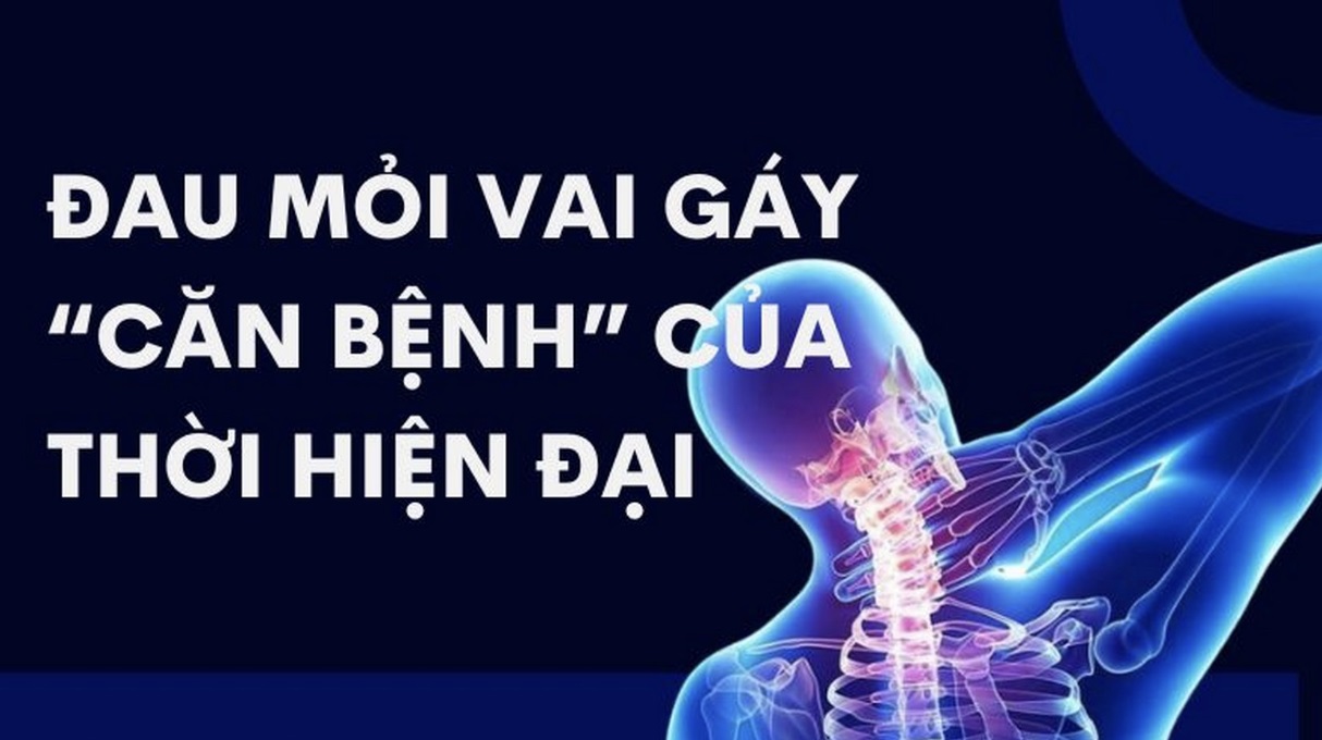 Chữa đau mỏi vai gáy bằng cách tập luyện và stretching kiểu Nhật