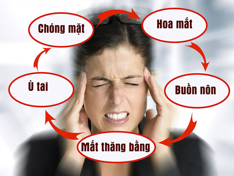 rối loạn tiền đình
