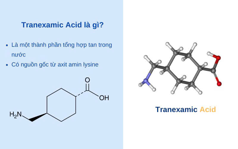 Hình ảnh bài viết