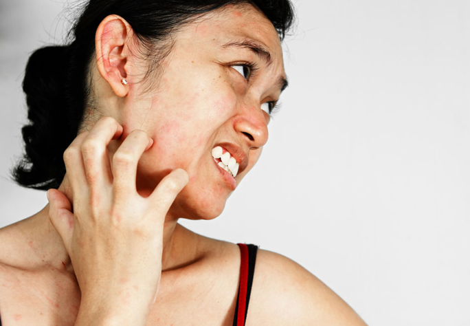 Hình ảnh bài viết