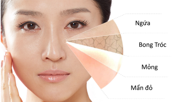 Hình ảnh bài viết