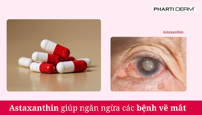 Hình ảnh bài viết