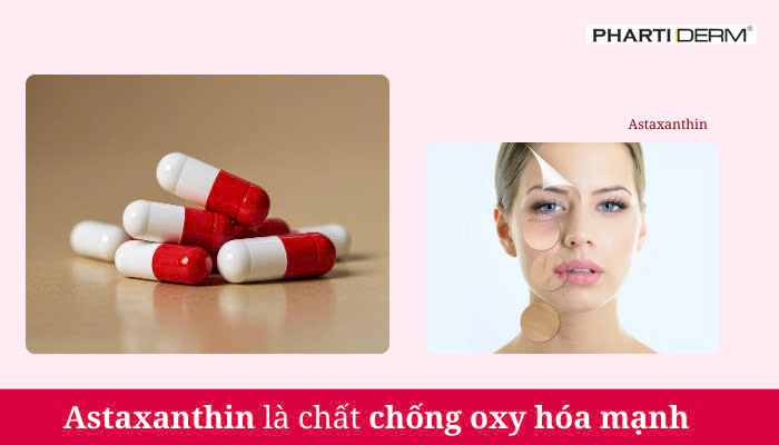 Hình ảnh bài viết