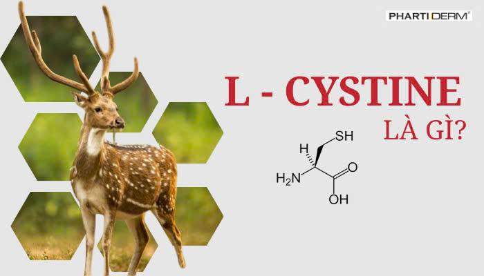 Hình ảnh bài viết