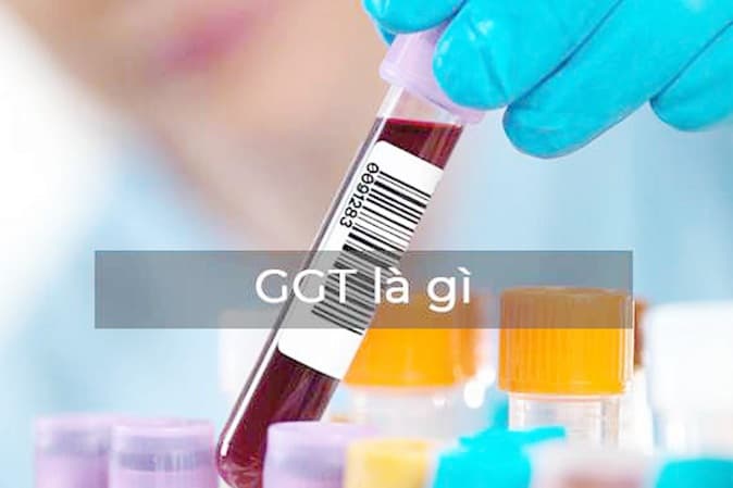 Chỉ số GTT là gì