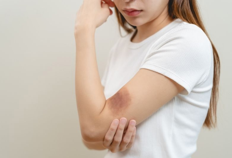 Dấu hiệu suy gan giai đoạn đầu