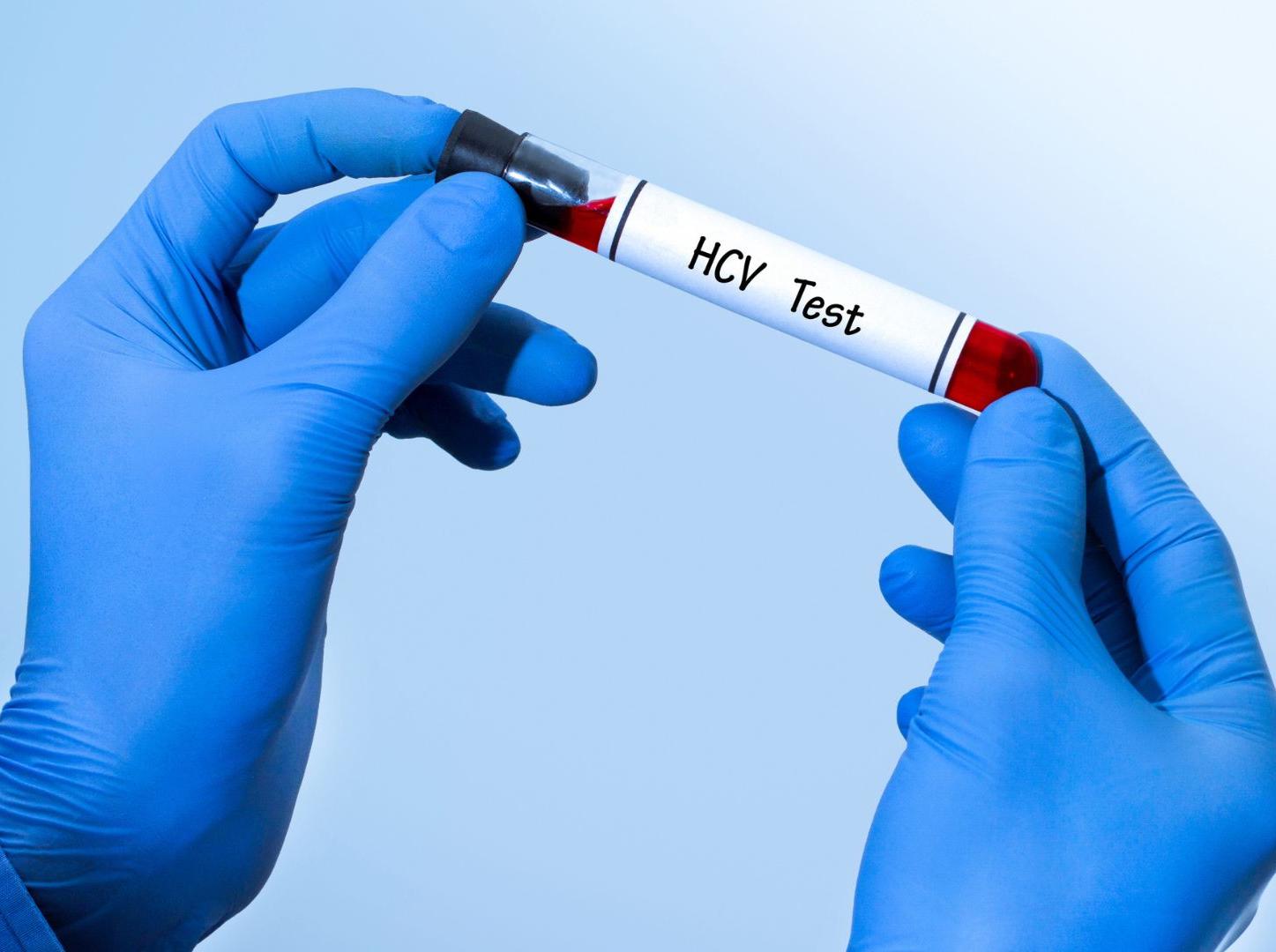 viêm gan C có vaccine không?