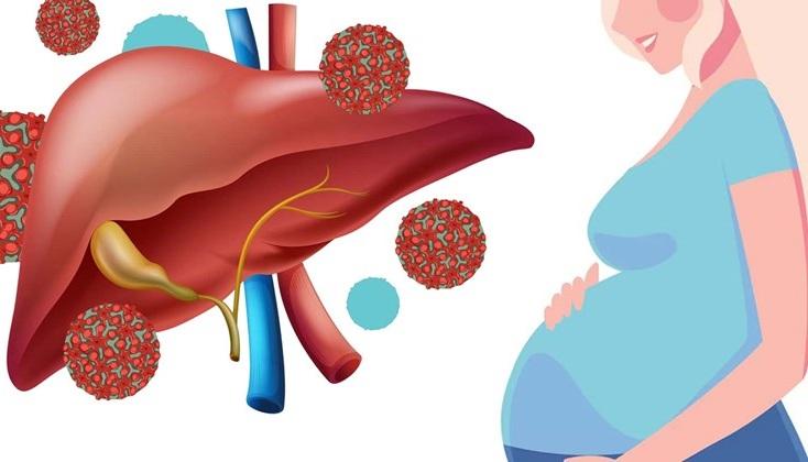 Viêm gan E ở phụ nữ mang thai