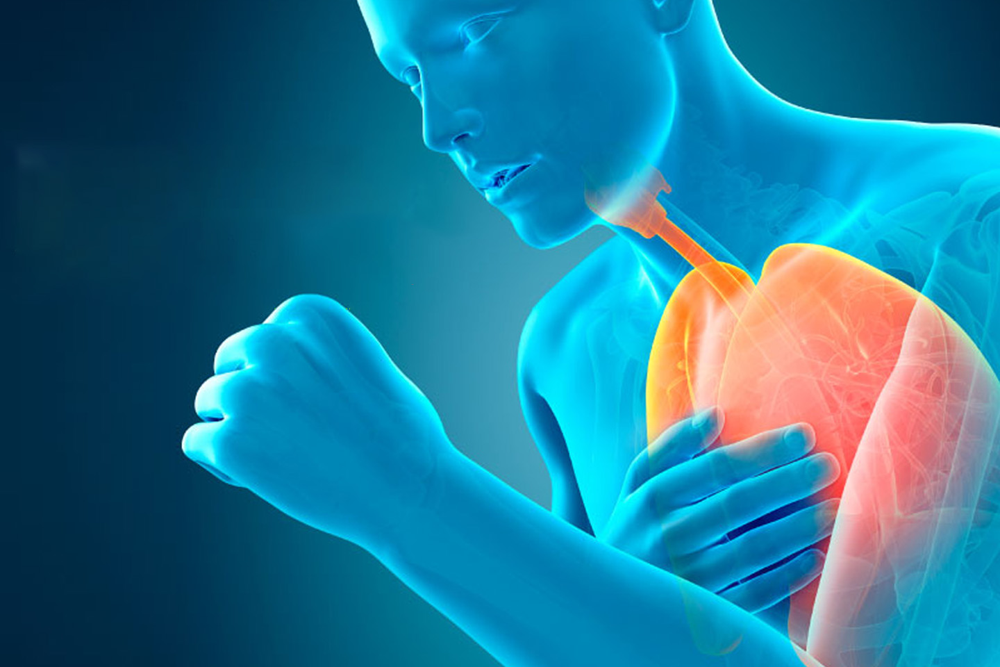 Viêm phế quản là bệnh gì