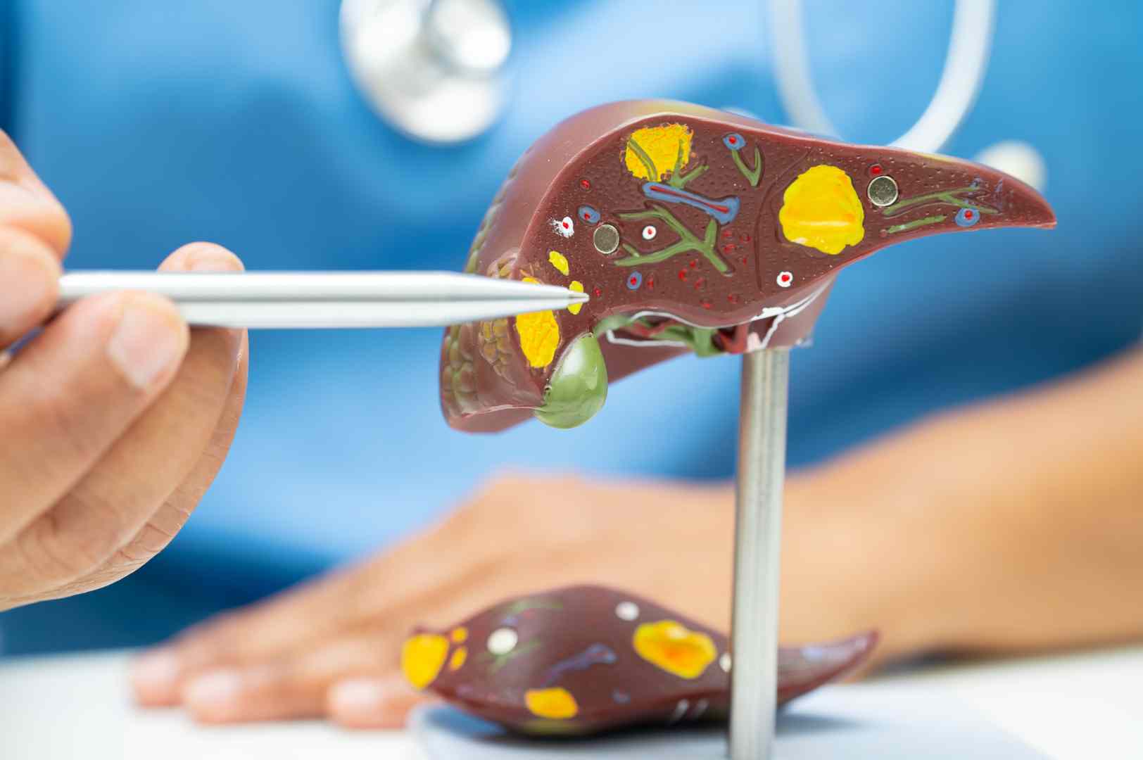 Xét nghiệm gan có cần nhịn ăn không