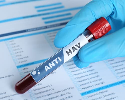 xét nghiệm viêm gan A (HAV) là gì?