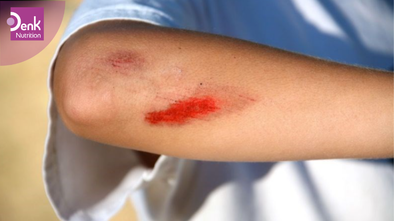 Vai trò của Arginine trong việc chữa lành và phục hồi vết thương