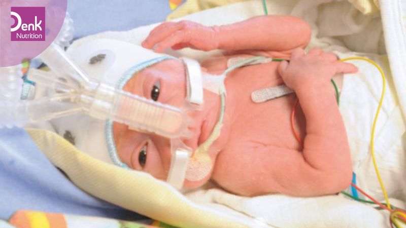 Giảm viêm đường tiêu hoá ở các trẻ sinh non tháng