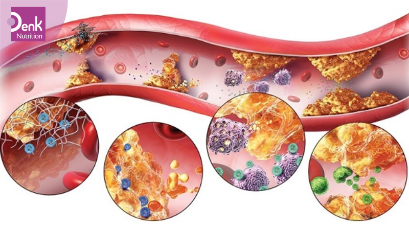 Tổng quan về bệnh rối loạn chuyển hóa axit béo