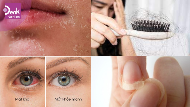 Dấu hiệu nhận biết cơ thể thiếu axit béo