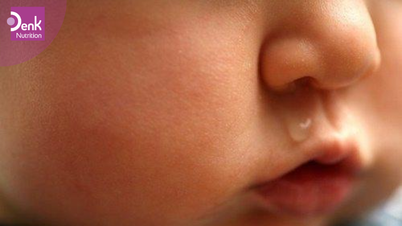 Dấu hiệu trẻ dị ứng đạm bò cha mẹ cần biết