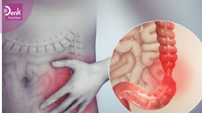 Cải thiện hội chứng ruột kích thích (IBS) và bệnh tiêu chảy
