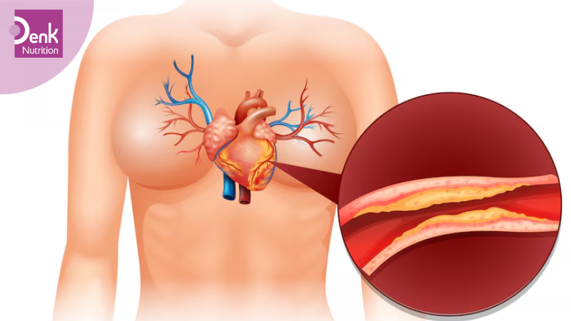 giảm nguy cơ mắc bệnh tim