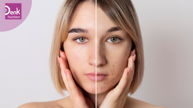 Kẽm và vitamin B12 giúp làn da khoẻ mạnh