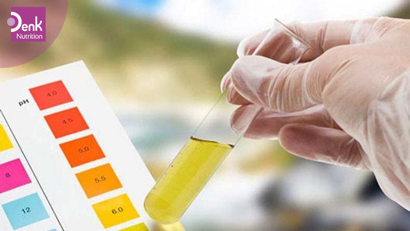 Protein niệu (có đạm trong nước tiểu)