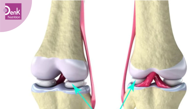 Glucosamine có tác dụng bảo vệ sụn