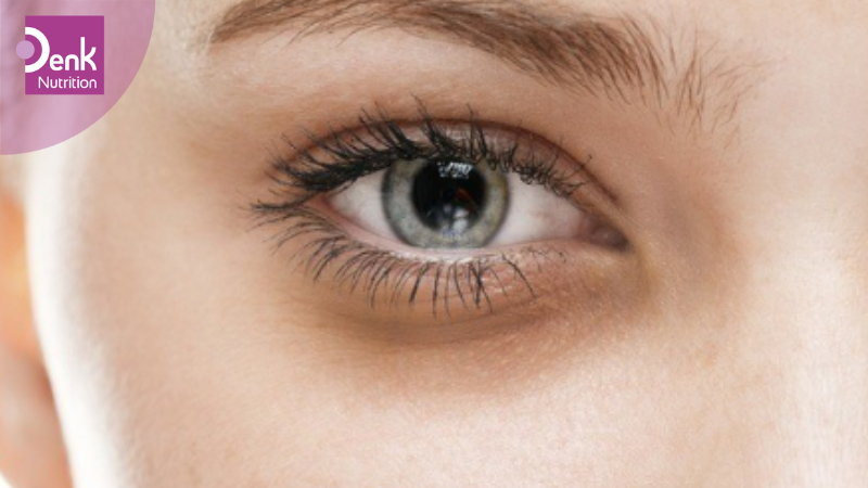 Làm mờ quầng thâm