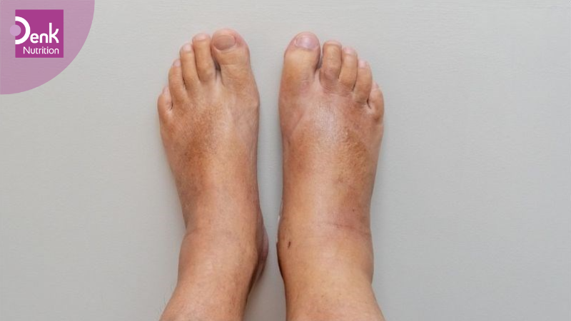 Có thể gây giữ nước