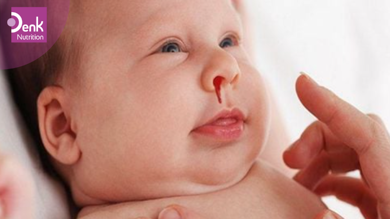 Các biểu hiện thiếu vitamin K ở trẻ sơ sinh