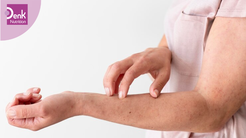 Triệu chứng trên da