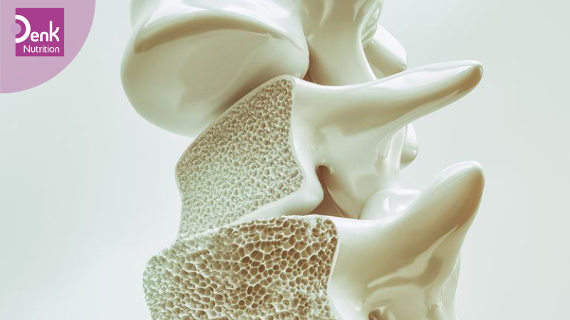 Cải thiện mật độ xương sau sinh