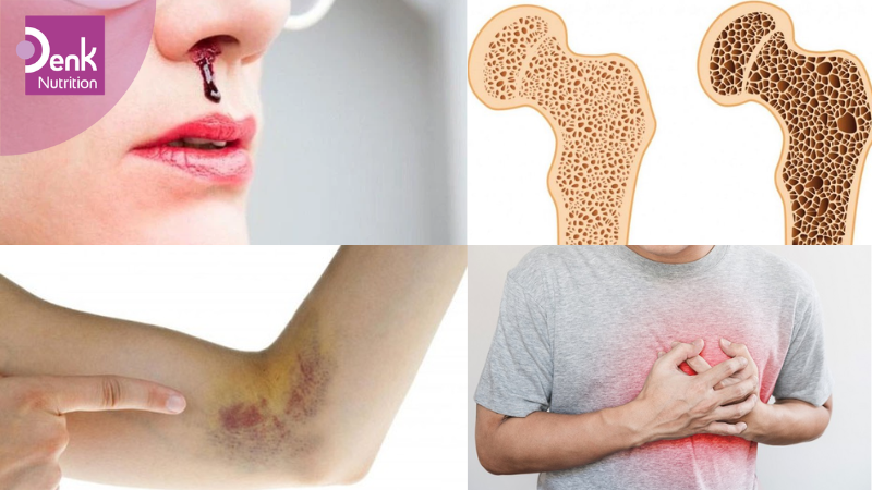 Triệu chứng thiếu hụt vitamin K