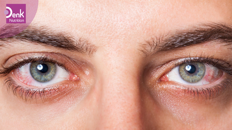 Phòng và điều trị bệnh lý về mắt