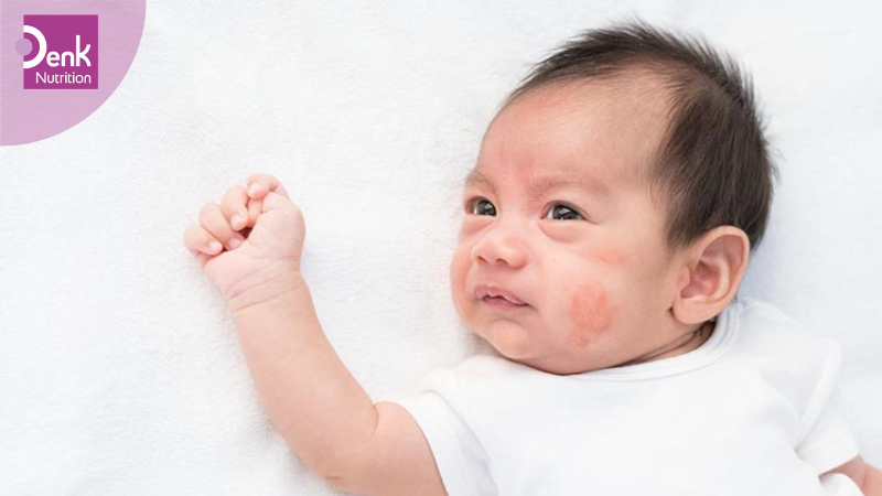 Khai thác tiền sử bệnh lý