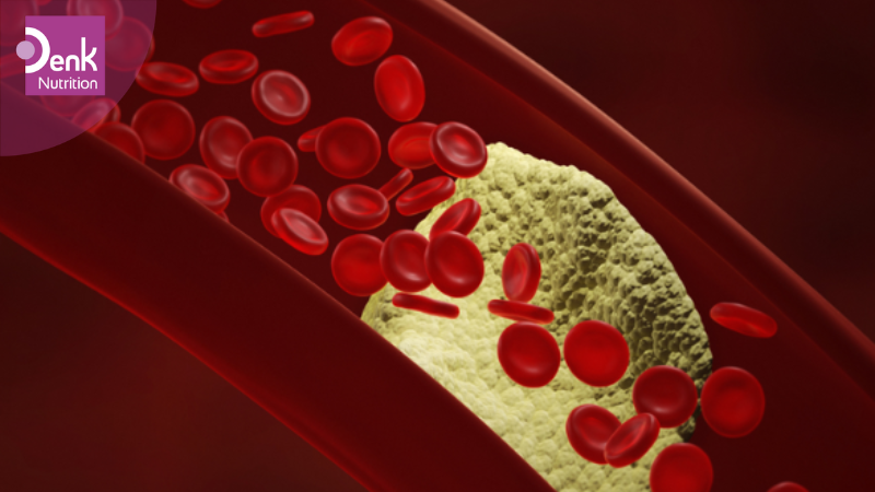 Vôi Hóa Động Mạch