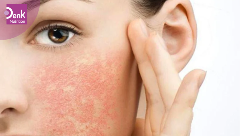 Các tác dụng phụ của Hyaluronic Acid