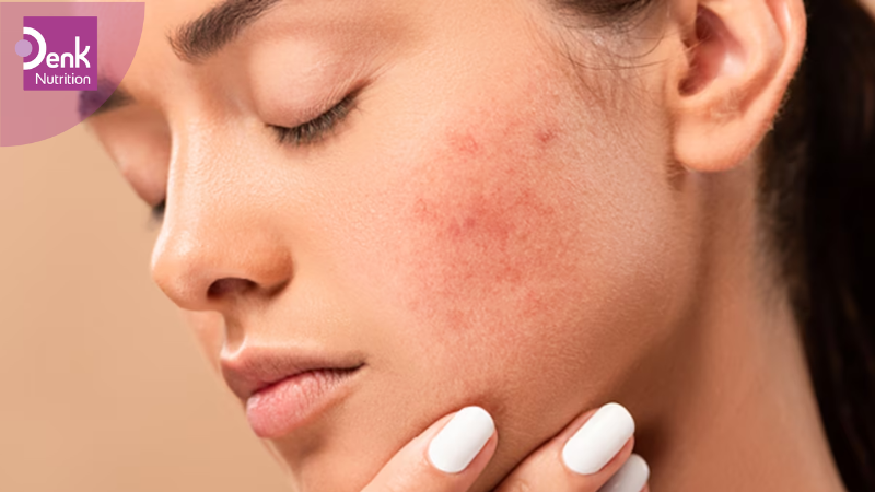 Tác dụng phụ của Hyaluronic Acid