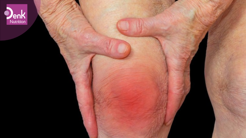 Giảm triệu chứng viêm khớp dạng thấp