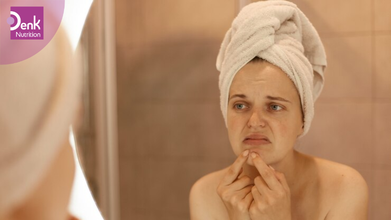 Giúp chống lại mụn trứng cá