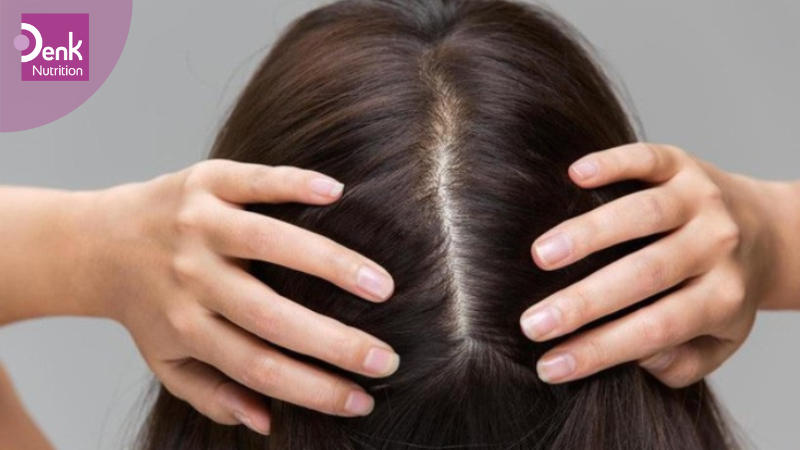 Giảm thiểu tình trạng ngứa da đầu