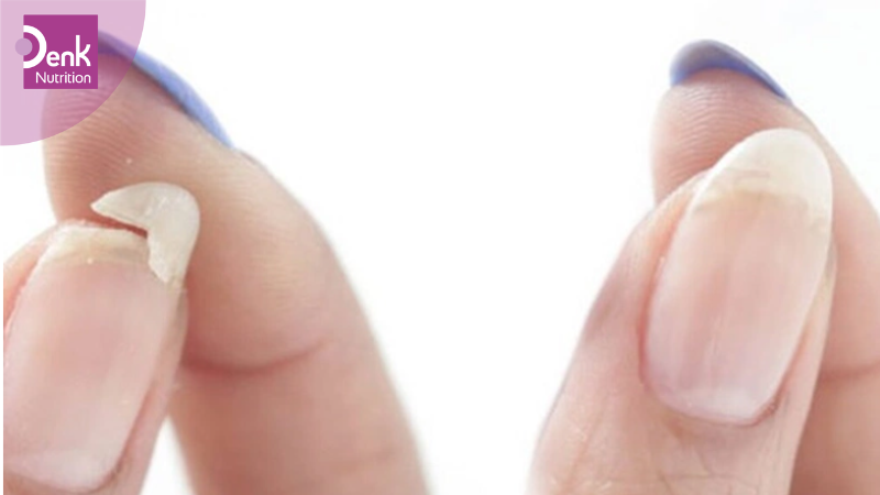 Xuất hiện các vấn đề liên quan đến cơ bắp, móng, da