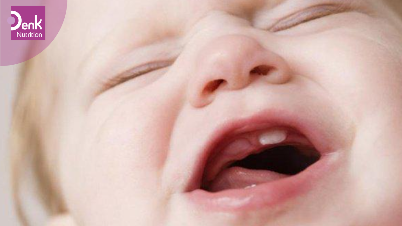 Mọc răng chậm có thể dẫn tới hậu quả gì?