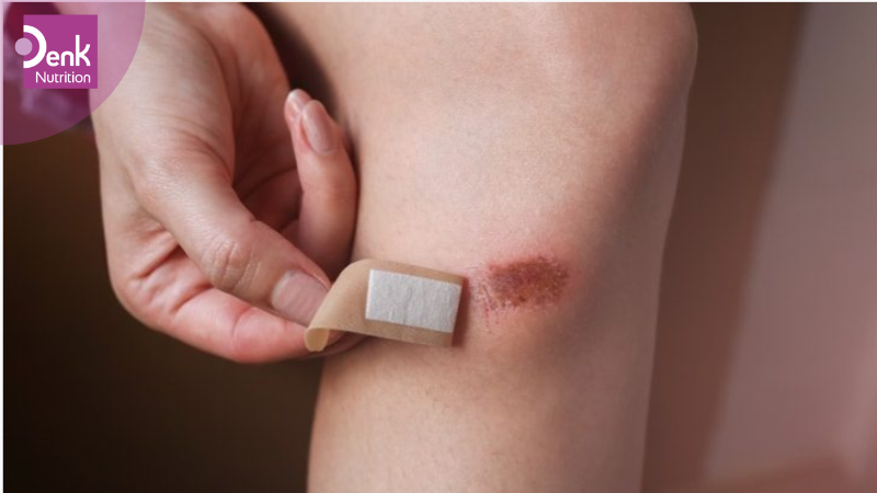 Làm chậm quá trình làm lành vết thương