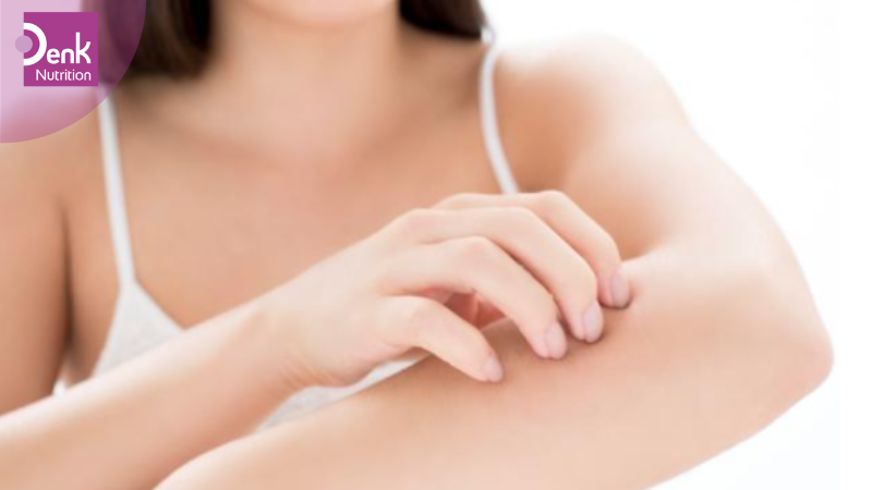 Giảm tình trạng ngứa da