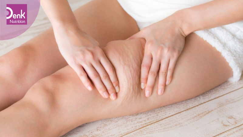 Giảm sự xuất hiện của cellulite trên da