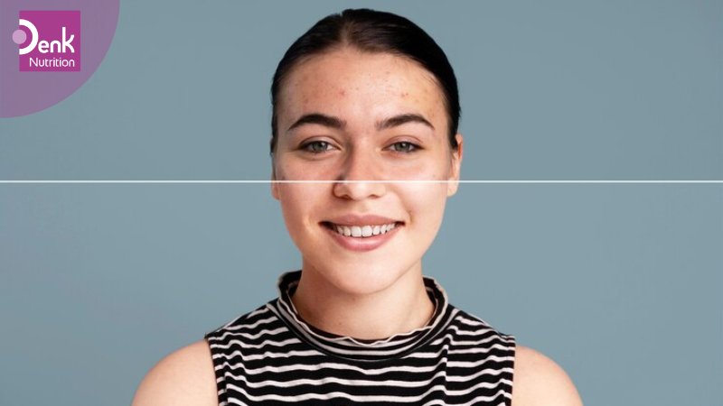 Vitamin B12 có thể cải thiện tình tạng viêm da mãn tính hoặc viêm da dị ứng.