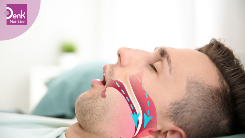 Mắc hội chứng ngưng thở